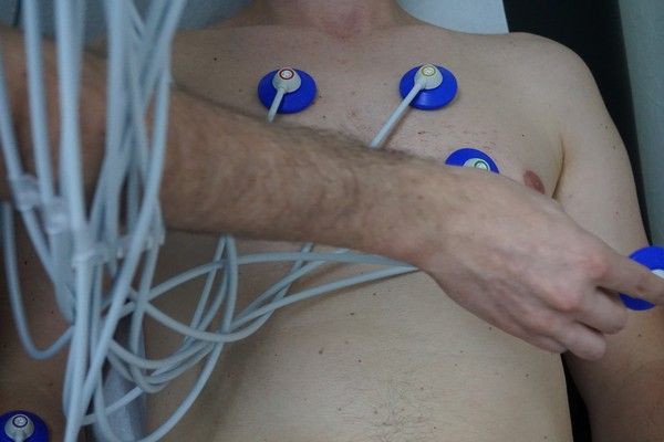 Ein EKG wird angelegt